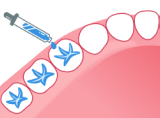 牙龈腫痛